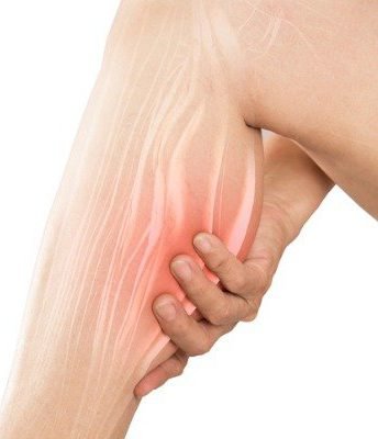 calf-muscle-pain-picture-id918099450 Fysiotherapie bij zweepslag 3